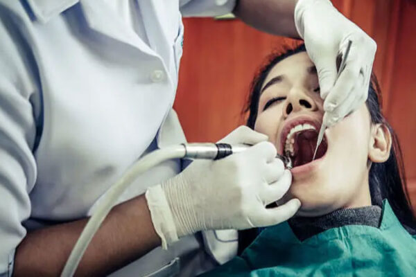 Wisdom tooth removal cost Dubai