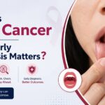 Oral Cancer Surgeon in Lucknow