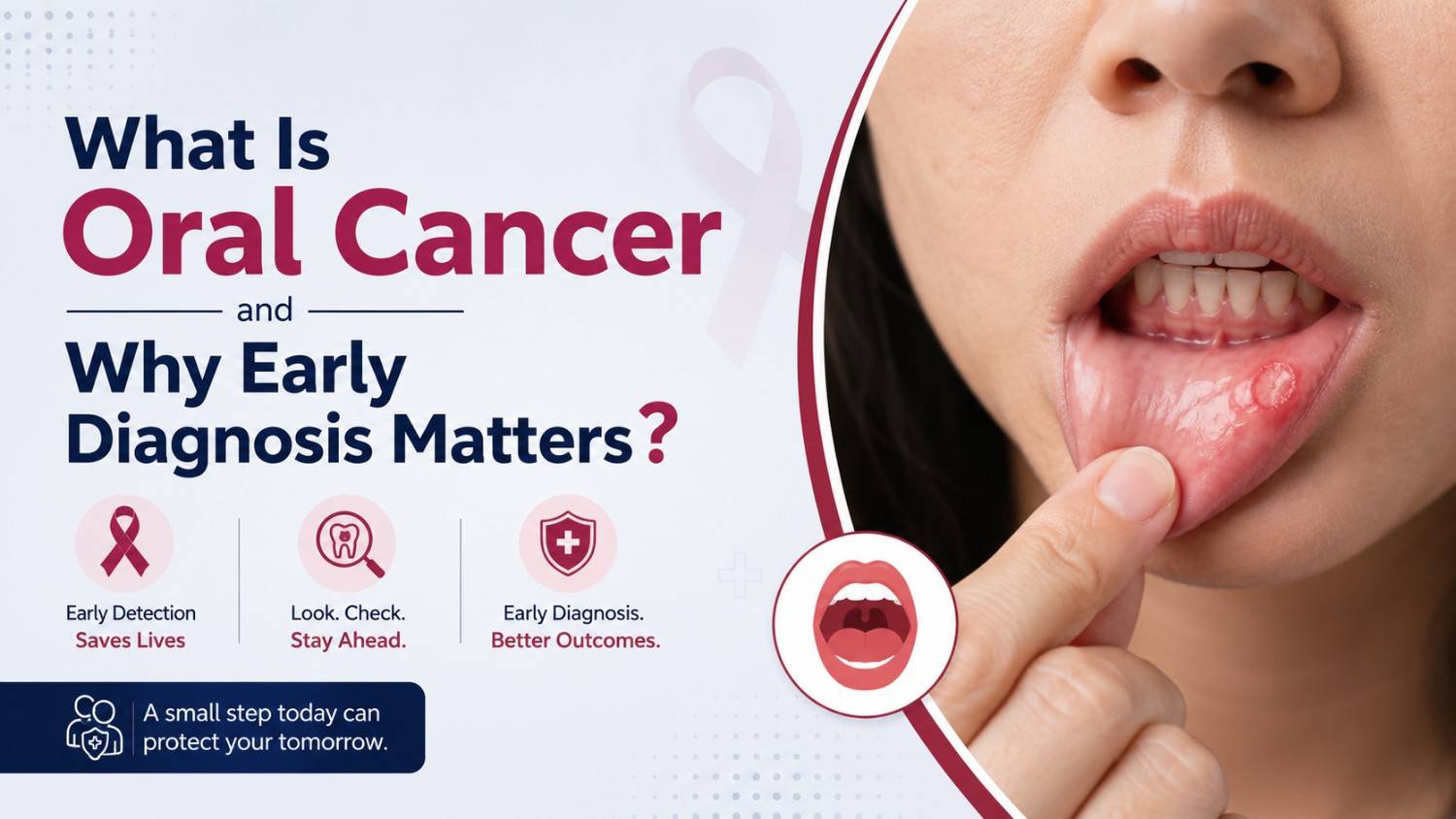 Oral Cancer Surgeon in Lucknow