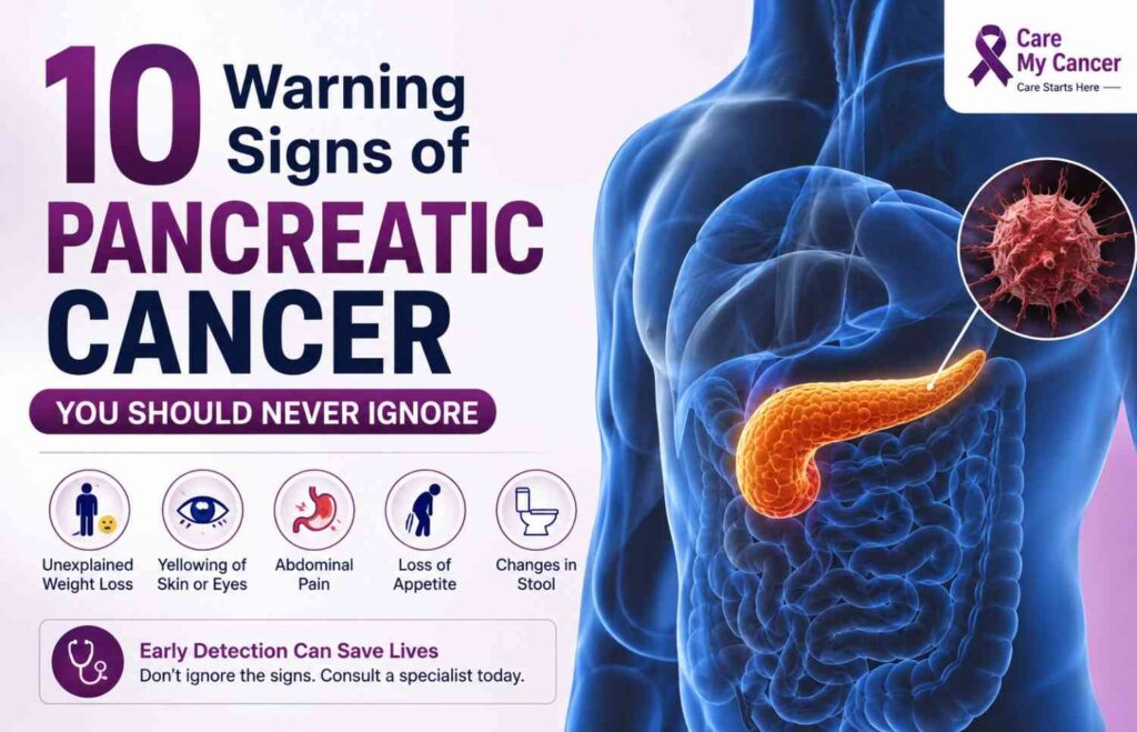 10 Warning Signs of Pancreatic Cancer