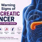 10 Warning Signs of Pancreatic Cancer