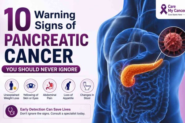 10 Warning Signs of Pancreatic Cancer