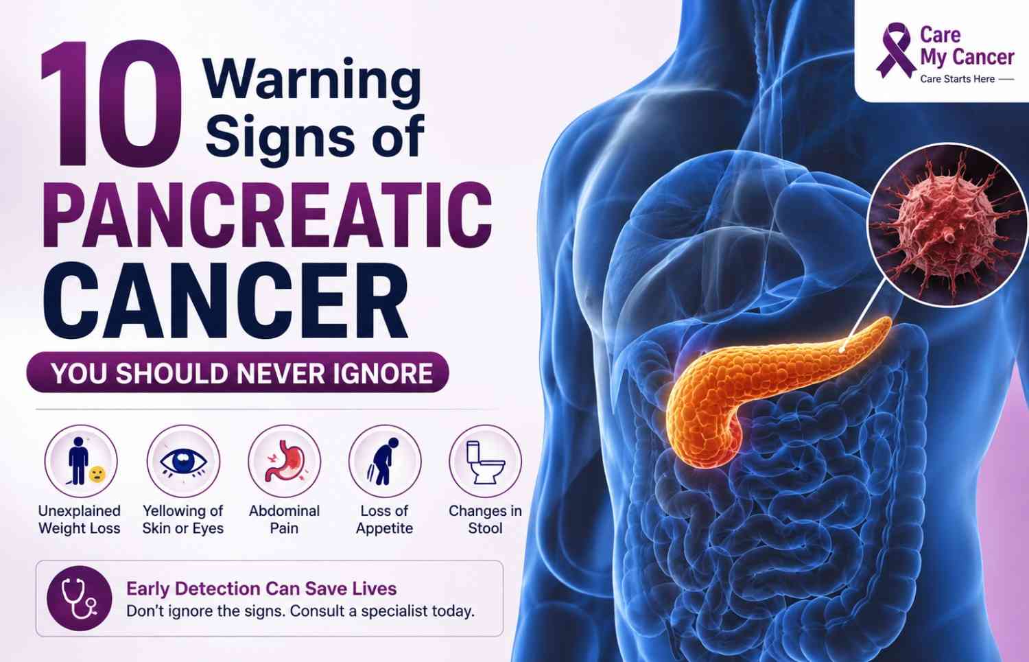 10 Warning Signs of Pancreatic Cancer