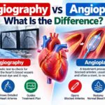Angiography vs Angioplasty